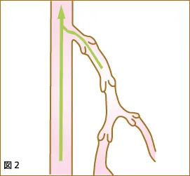 原因説明図2